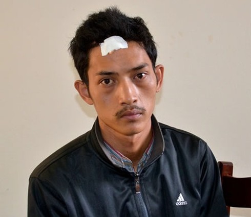 Tự đập đầu chảy máu để