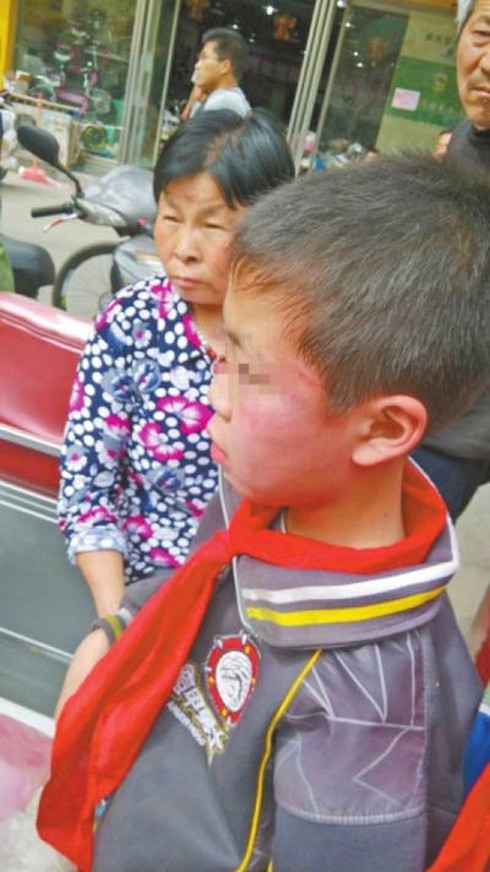 Chơi trưa không về, một cậu bé bị mẹ tát bầm tím mặt - ảnh 1