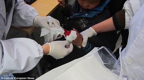 Giận chồng, chặt đứt 3 ngón tay con trai 8 tuổi - ảnh 1