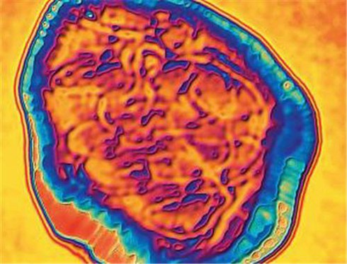 Sẽ có thuốc kháng virus chặn đứng bệnh sởi? - ảnh 1