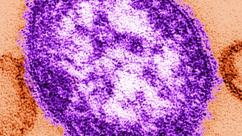Thuốc mới phòng bệnh sởi cho người chưa được tiêm vaccin - ảnh 1