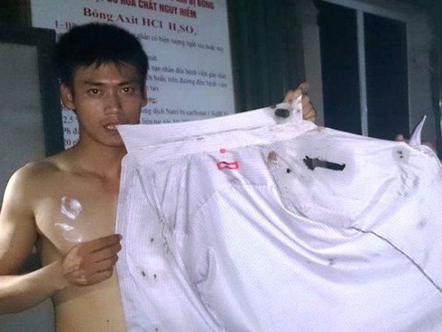 Truy đuổi xe nghi ngờ chở axit gây bỏng cho người đi đường - ảnh 2