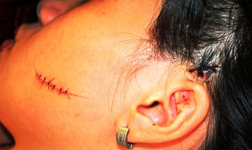 Bắt quả tang ngoại tình, dùng dao lam rạch mặt tình địch - ảnh 1