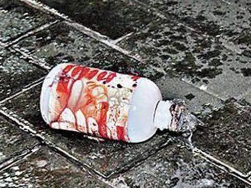 Kinh sợ thói ghen ngược: Tạt axit hủy hoại vợ sắp cưới của chồng cũ - ảnh 1