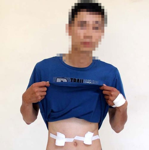 Giả bị cướp để trì hoãn trả nợ - ảnh 1