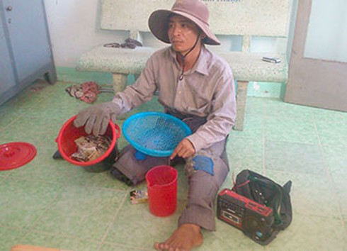 Giả cụt chân làm “cái bang” thu nhập 300 – 400.000 đồng/ngày - ảnh 1