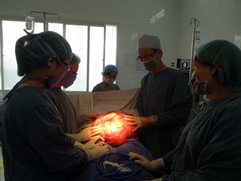Phẫu thuật thành công khối u hơn mười cân cho bệnh nhân khiếm thị - ảnh 1