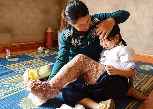 Hành trình đứng lên phi thường của cô bé