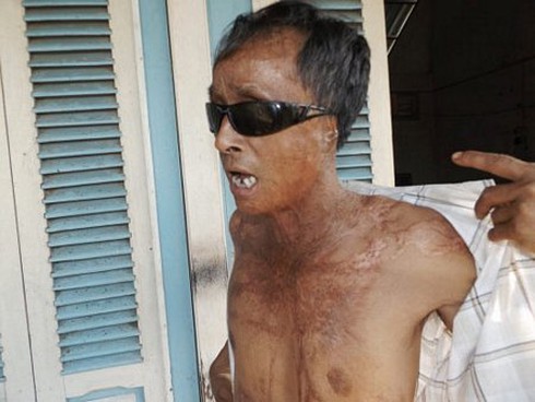 Kết cục bi thảm chuyện tình