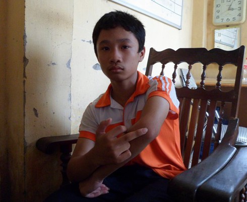 Côn đồ ngang nhiên vác gậy đánh gãy tay bé trai 12 tuổi - ảnh 1