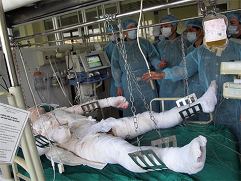Vụ nổ Phú Thọ: 73 nạn nhân được cứu chữa tại BV quân đội, khu vực - ảnh 2