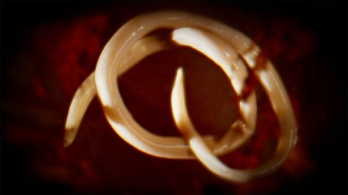 Những phương pháp làm đẹp 'kinh khủng' trên thế giới - ảnh 2