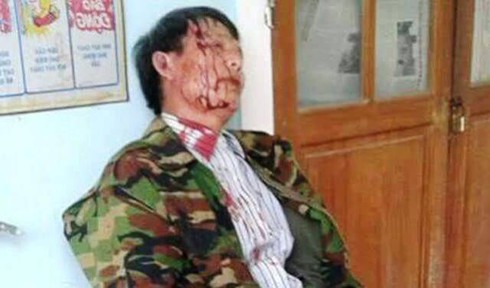 Người dân bị trưởng công an xã đánh nhập viện vì ghi âm nói gì? - ảnh 1