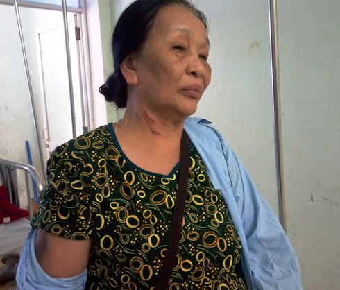 Quảng Bình: Nghi án hai vợ chồng cụ già vô cớ bị hàng xóm đánh nhập viện - ảnh 2