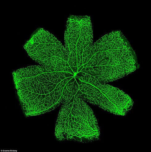 Chùm ảnh ấn tượng về máu và hệ tuần hoàn - ảnh 5