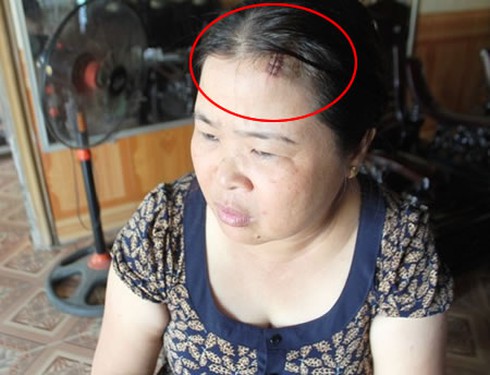Hùng hổ chưa kịp chém người đã bị truy sát - ảnh 3