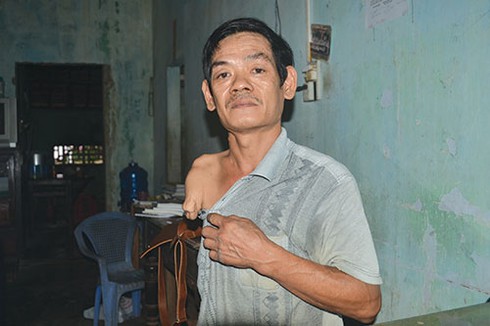 Sự thật người cụt chân, tay có bằng lái xe? - ảnh 1