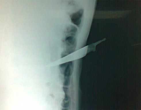 Bị truy đuổi, đối tượng truy nã dùng dao tự sát - ảnh 1