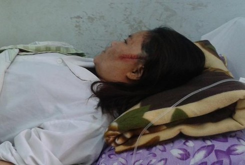 Bố chồng chém con dâu nhập viện - ảnh 1