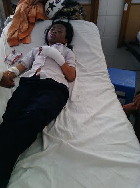 Nổ bóng bay, 2 thầy giáo và 11 học sinh bị bỏng - ảnh 2