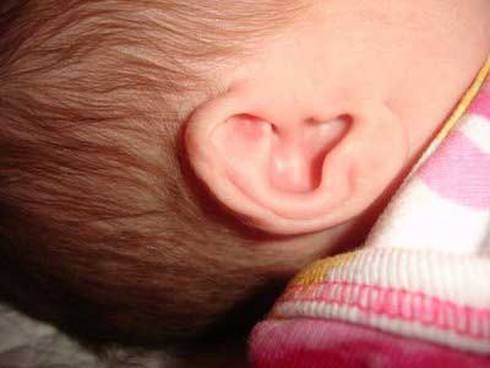 Dấu hiệu biết trẻ bị thủng màng nhĩ - ảnh 1