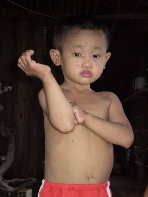Bé trai mắc bệnh lạ - ảnh 1