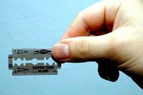Rạch mặt tình địch bằng lưỡi dao lam, lĩnh án 2 năm tù treo - ảnh 1