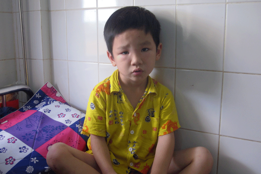 Bị bầy ong vò vẽ đốt, bé trai phải nhập viện cấp cứu - ảnh 1
