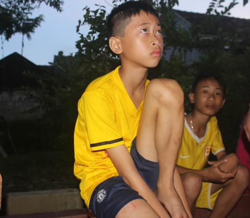 Sập giàn bồn chứa nước tại trường học, 2 học sinh tử vong tại chỗ - ảnh 2