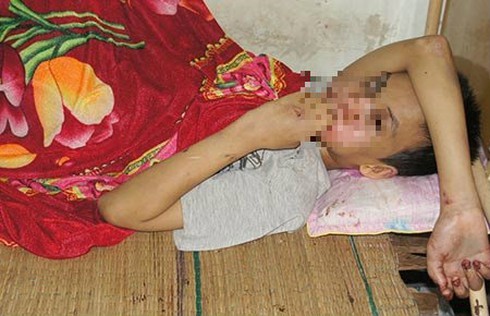 Bé trai khuyết tật bị bắt cóc, đánh đập - ảnh 1