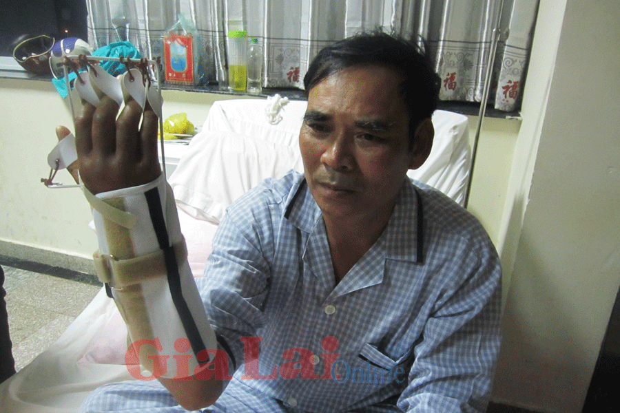 Kiểm lâm viên bị chém đứt nửa cổ tay - ảnh 1