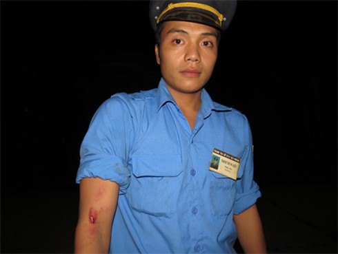 Lái xe cào cấu, cắn Thanh tra giao thông Hải Phòng - ảnh 1