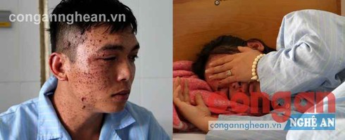 Ôm mìn tự sát tại nhà riêng, 6 người thương vong - ảnh 1