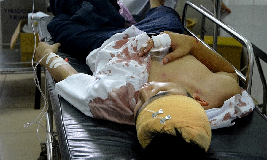 Nam sinh bị chém trọng thương ngay trước cổng trường - ảnh 1