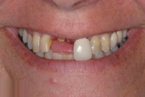 Đánh hàng xóm gãy răng, lãnh án 9 tháng tù - ảnh 1
