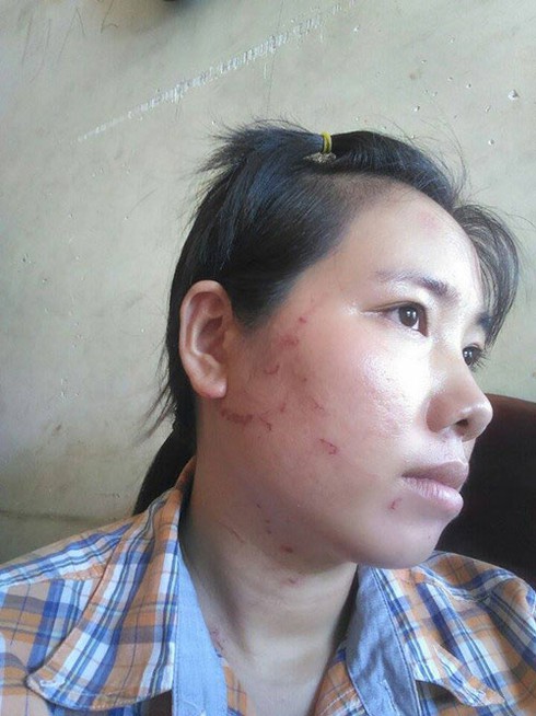 Vụ cân thiếu rồi đánh du khách: Chính quyền xử lý nghiêm minh - ảnh 1