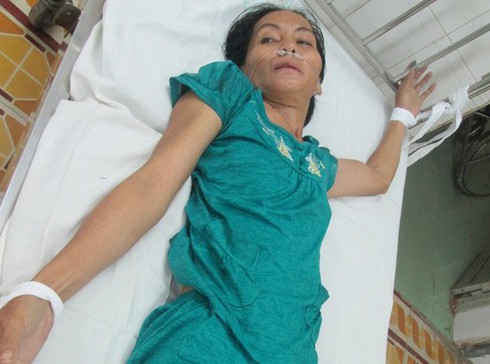 Vụ đâm dao vào đầu cháu bé 11 ngày tuổi: Chưa rõ động cơ của nghi phạm - ảnh 1