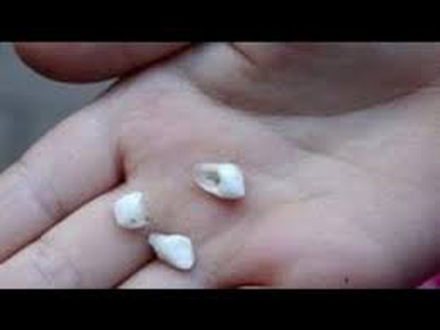 Vợ đánh chồng gãy 4 chiếc răng - ảnh 1