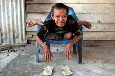 Người”cao su” trong tư thế