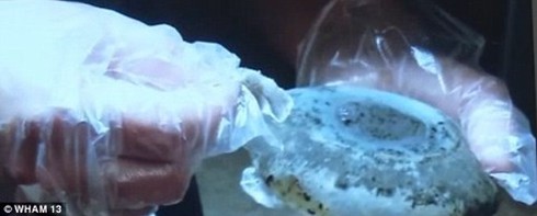 Độn ngực silicon của mẹ bị nhiễm nấm, con bú vào suýt chết - ảnh 1