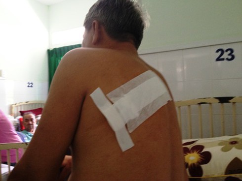 Côn đồ xách mã tấu chém gục người cựu chiến binh - ảnh 2