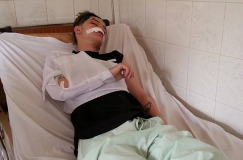 Gặp cướp, 'hot boy' Kelbin Lei nhập viện với nhiều vết thương - ảnh 1
