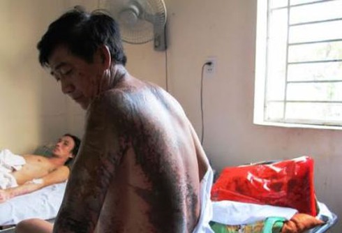 4 người đàn ông hứng trọn ca axít khi đi tập thể dục - ảnh 1