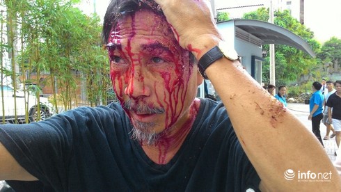 Vụ chung cư 4S: Ai chỉ đạo nhóm côn đồ đánh cư dân? - ảnh 2