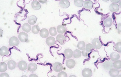 TPHCM: Người đầu tiên nhiễm trùng roi lạ - ảnh 1