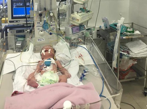 Bé trai mổ tim ngay sau khi chào đời - ảnh 1