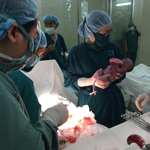 Bé trai mổ tim ngay sau khi chào đời - ảnh 2