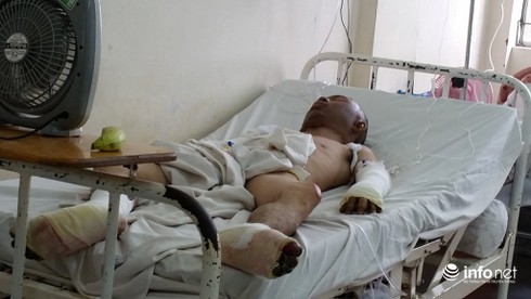 Vụ cháy khiến bé 2 tuổi tử vong: Người cha bị bỏng và sốc nặng - ảnh 1