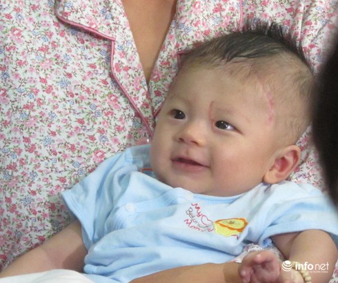 Sức khỏe bé trai bị dao đâm thấu sọ khá tốt trong ngày tái khám - ảnh 1