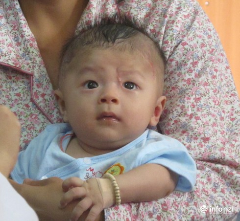 Sức khỏe bé trai bị dao đâm thấu sọ khá tốt trong ngày tái khám - ảnh 2